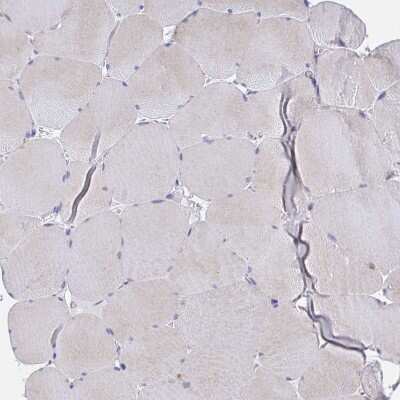 Immunohistochemistry-Paraffin: Golgin 97 Antibody [NBP2-38528] - Staining of human skeletal muscle shows very weak positivity in myocytes.