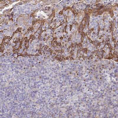 Immunohistochemistry-Paraffin: Golgin 97 Antibody [NBP2-38528] - Staining of human tonsil shows moderate cytoplasmic positivity in squamous epithelial cells.