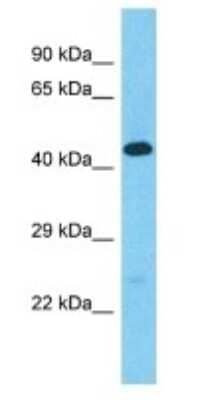 Western Blot Golgin A6 Family-Like 2 Antibody