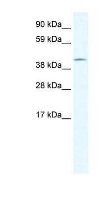 Western Blot: Gonadotropin Inducible Transcription Repressor 1 Antibody [NBP1-80177] - Titration: 1.25ug/ml, Positive Control: Human Thymus.