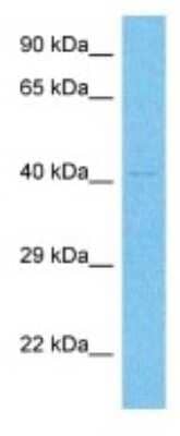 Western Blot: Gonadotropin Inducible Transcription Repressor 1 Antibody [NBP3-10529] - Western blot analysis of Gonadotropin Inducible Transcription Repressor 1 in NCI-H226 Whole Cell lysates. Antibody dilution at 1.0ug/ml