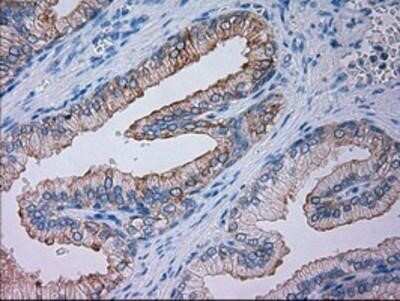 Immunohistochemistry: Goosecoid Antibody (OTI1D7) - Azide and BSA Free [NBP2-72409] - Staining of paraffin-embedded Human prostate tissue using anti-GSC mouse monoclonal antibody.