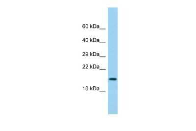 Western Blot: Gr-1/Ly-6G Antibody [NBP3-09524] - Western blot analysis of Gr-1/Ly-6G in Fetal Lung lysates. Antibody dilution at 1.0ug/ml