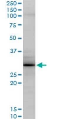 Western Blot: Grancalcin Antibody (2F11) [H00025801-M04] - Analysis of GCA expression in IMR-32 (Cat # L008V1).