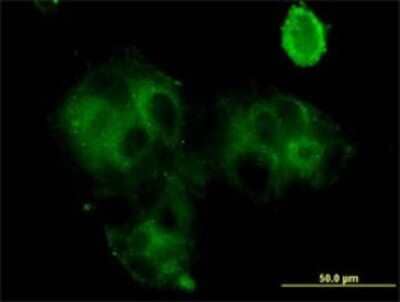 Immunocytochemistry/Immunofluorescence: Grancalcin Antibody (2F5) [H00025801-M01] - Analysis of monoclonal antibody to GCA on MCF-7 cell . Antibody concentration 10 ug/ml.