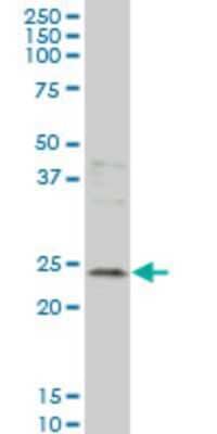 Western Blot: Grancalcin Antibody (2F5) [H00025801-M01] - GCA monoclonal antibody (M01), clone 2F5 Analysis of GCA expression in MCF-7.