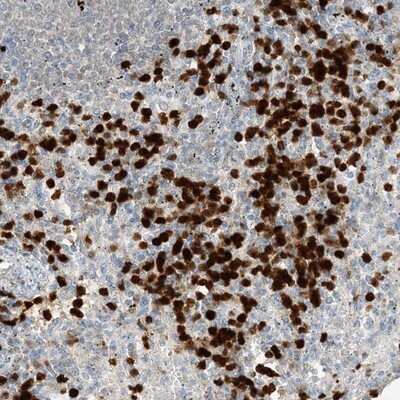 Immunohistochemistry-Paraffin: Grancalcin Antibody [NBP1-89786] - Staining of human spleen shows strong nuclear positivity in cells in red pulp.