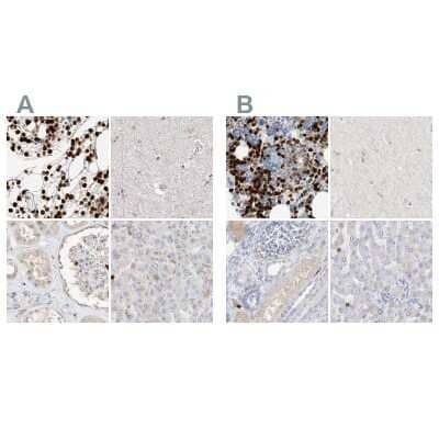 <b>Independent Antibodies Validation. </b>Immunohistochemistry-Paraffin: Grancalcin Antibody [NBP1-89786] - Staining of human bone marrow, cerebral cortex, kidney and liver using Anti-GCA antibody NBP1-89786 (A) shows similar protein distribution across tissues to independent antibody NBP1-89785 (B).