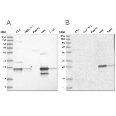 Western Blot: Grancalcin Antibody [NBP1-89786] - Analysis using Anti-GCA antibody NBP1-89786 (A) shows similar pattern to independent antibody NBP1-89785 (B).