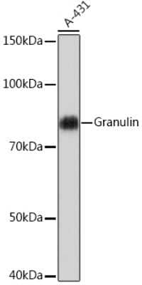 Western Blot: Granulin Antibody (4X3I7) [NBP3-16566] - Western blot analysis of extracts of A-431 cells, using Granulin Rabbit mAb (NBP3-16566) at 1:1000 dilution. Secondary antibody: HRP Goat Anti-Rabbit IgG (H+L) at 1:10000 dilution. Lysates/proteins: 25ug per lane. Blocking buffer: 3% nonfat dry milk in TBST. Detection: ECL Basic Kit. Exposure time: 3min.