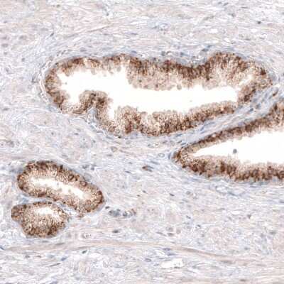 Immunohistochemistry-Paraffin: Granulin Antibody (CL5695) [NBP2-61425] - Staining of human prostate shows moderate granular cytoplasmic immunoreactivity in glandular cells.