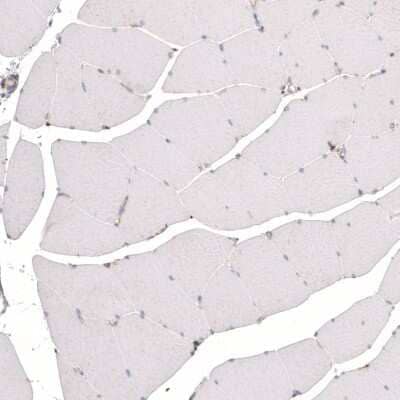 Immunohistochemistry-Paraffin: Granulin Antibody (CL5695) [NBP2-61425] - Staining of human skeletal muscle shows absence of positivity in striated muscle fibers as expected (negative control).