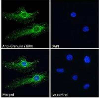 Immunocytochemistry/Immunofluorescence: Granulin Antibody [NBP1-26396] - Immunofluorescence analysis of paraformaldehyde fixed HeLa cells, permeabilized with 0.15% Triton. Primary incubation 1hr (10 ug/mL) followed by Alexa Fluor 488 secondary antibody (2 ug/mL), showing ER/vesicle staining. The nuclear stain is DAPI (blue). Negative control: Unimmunized goat IgG (10 ug/mL) followed by Alexa Fluor 488 secondary antibody (2 ug/mL).