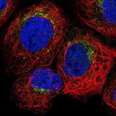 Immunocytochemistry/Immunofluorescence: Granulin Antibody [NBP1-87325] - Staining of human cell line A-431 shows localization to endoplasmic reticulum, endosomes & lysosomes. Antibody staining is shown in green.