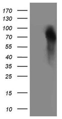 Western Blot: Granulin Antibody (OTI3H6) - Azide and BSA Free [NBP2-70847] - HEK293T cells were transfected with the pCMV6-ENTRY control (Left lane) or pCMV6-ENTRY GRN (Right lane) cDNA for 48 hrs and lysed. Equivalent amounts of cell lysates (5 ug per lane) were separated by SDS-PAGE and immunoblotted with anti-GRN.