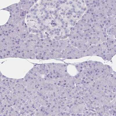 Immunohistochemistry-Paraffin: Granulysin Antibody [NBP2-38839] - Staining of human pancreas shows no positivity in exocrine glandular cells as expected.