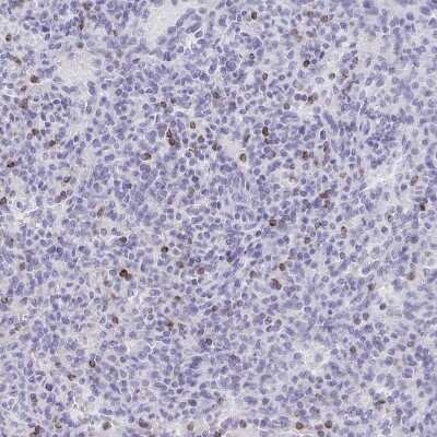 <b>Orthogonal Strategies Validation. </b>Immunohistochemistry-Paraffin: Granulysin Antibody [NBP2-38839] - Staining of human spleen shows strong cytoplasmic positivity in cells in red pulp.