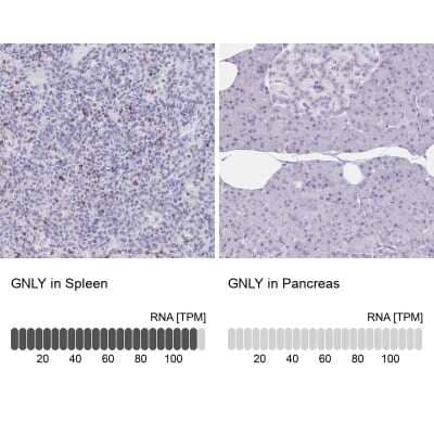 Immunohistochemistry-Paraffin: Granulysin Antibody [NBP2-38839] - Analysis in human spleen and pancreas tissues. Corresponding Granulysin RNA-seq data are presented for the same tissues.