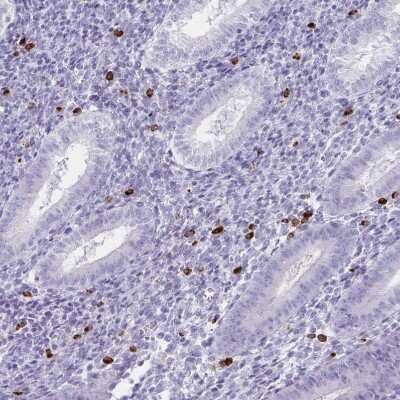 Immunohistochemistry-Paraffin: Granulysin Antibody [NBP2-38839] - Staining of human endometrium strong cytoplasmic positivity in lymphoid cells.