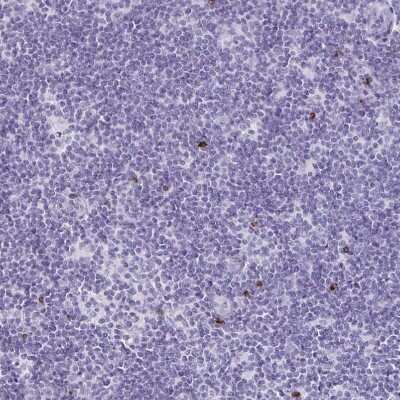 Immunohistochemistry-Paraffin: Granulysin Antibody [NBP2-38839] - Staining of human lymph node shows strong cytoplasmic positivity in a small subset of non-germinal center cells.