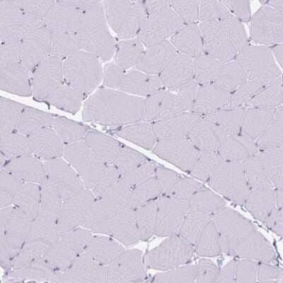 Immunohistochemistry-Paraffin: Granulysin Antibody [NBP2-38839] - Staining of human skeletal muscle no positivity in myocytes as expected.