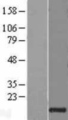 Western Blot: Granulysin Overexpression Lysate (Adult Normal) [NBL1-11185] Left-Empty vector transfected control cell lysate (HEK293 cell lysate); Right -Over-expression Lysate for Granulysin.