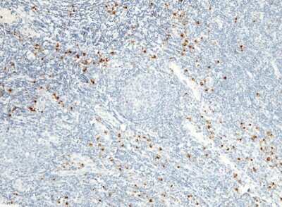Immunohistochemistry-Paraffin: Granzyme B Antibody (2) [NBP2-89439] - Staining of human Granzyme B in human tonsil with rabbit monoclonal antibody (1:1000).