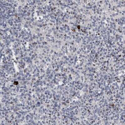 Immunohistochemistry-Paraffin: Granzyme H Antibody [NBP1-86565] - Staining of human spleen shows high expression.