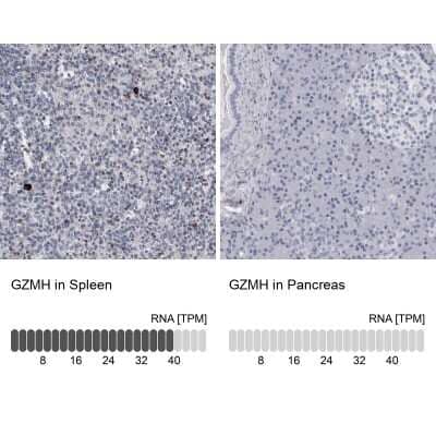 Immunohistochemistry-Paraffin Granzyme H Antibody