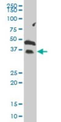 Western Blot: Granzyme H Antibody [H00002999-B01P] - Analysis of GZMH expression in human colon.