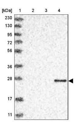 <b>Orthogonal Strategies Validation. </b>Western Blot: Granzyme H Antibody [NBP1-86565] - Lane 1: Marker  [kDa] 230, 130, 95, 72, 56, 36, 28, 17, 11.  Lane 2: Human cell line RT-4.  Lane 3: Human cell line U-251MG sp.  Lane 4: Human plasma (IgG/HSA depleted)