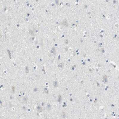 Immunohistochemistry-Paraffin: Granzyme M Antibody [NBP2-14079] - Staining of human cerebral cortex shows low expression as expected.