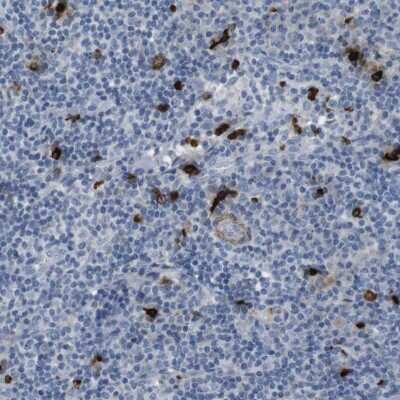 <b>Orthogonal Strategies Validation. </b>Immunohistochemistry-Paraffin: Granzyme M Antibody [NBP2-14079] - Staining of human lymph node shows high expression.