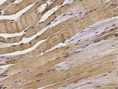 Immunohistochemistry-Paraffin: Gremlin 1 Antibody [NBP2-98208] - Staining of mouse Gremlin 1 in Mouse heart with rabbit polyclonal antibody (1:200).