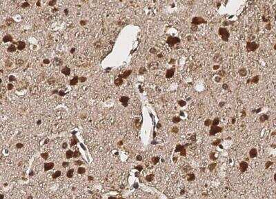 Immunohistochemistry-Paraffin: Gremlin 1 Antibody [NBP2-98208] - Staining of mouse GREM1 in mosue brain with rabbit polyclonal antibody (1:200).