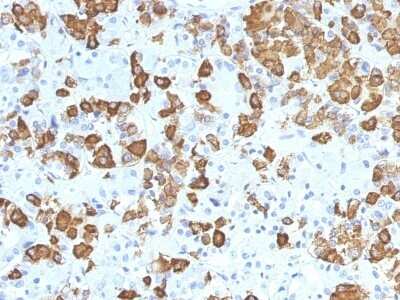 Immunohistochemistry-Paraffin: Growth Hormone Antibody (GH/1371) [NBP2-53261] - Formalin-fixed, paraffin-embedded Human Pituitary stained with Growth Hormone Monoclonal Antibody (GH/1371).