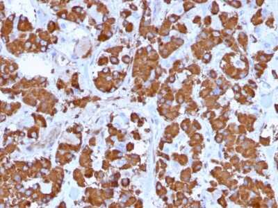 Immunohistochemistry-Paraffin: Growth Hormone Antibody (GH/1371) [NBP2-53261] - Formalin-fixed, paraffin-embedded human Pituitary stained with Growth Hormone Antibody (GH/1371).