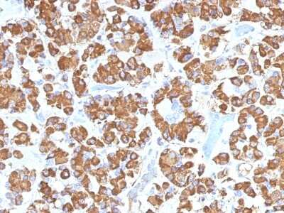 Immunohistochemistry-Paraffin: Growth Hormone Antibody (GH/1450) [NBP2-54356] - Formalin-fixed, paraffin-embedded Human Pituitary stained with Growth Hormone Monoclonal Antibody (GH/1450).