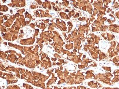 Immunohistochemistry-Paraffin: Growth Hormone Antibody (GH/4886R) [NBP3-13925] - Formalin-fixed, paraffin-embedded human pituitary stained with Growth Hormone antibody (GH/4886R).