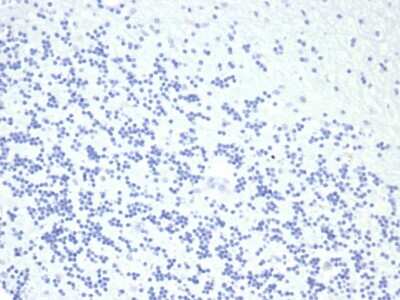 Immunohistochemistry-Paraffin: Growth Hormone Antibody (GH/4886R) [NBP3-13925] - IHC analysis of formalin-fixed, paraffin-embedded human brain. Negative tissue control using Growth Hormone antibody (GH/4886R) at 2ug/ml in PBS for 30min RT. HIER: Tris/EDTA, pH9.0, 45min. HRP-polymer, 30min. DAB, 5min.