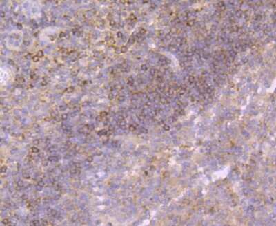 Immunohistochemistry-Paraffin: Growth Hormone Antibody (JM108-09) [NBP2-66893] - Analysis of paraffin-embedded human tonsil tissue using anti-Growth Hormone antibody. Counter stained with hematoxylin.