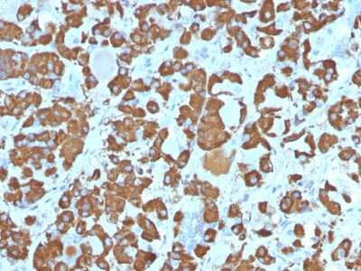 Immunohistochemistry-Paraffin: Growth Hormone Antibody (SPM106) [NBP2-54352] - Formalin-fixed, paraffin-embedded Human Pituitary stained with Growth Hormone Monoclonal Antibody (SPM106).