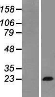 Western Blot: Growth Hormone Overexpression Lysate (Adult Normal) [NBP2-10676] Left-Empty vector transfected control cell lysate (HEK293 cell lysate); Right -Over-expression Lysate for Growth Hormone.