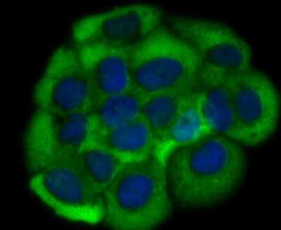 Immunocytochemistry/Immunofluorescence: Growth Hormone R Antibody (JU01-34) [NBP2-75518] - Staining Growth hormone receptor in JAR cells (green). The nuclear counter stain is DAPI (blue). Cells were fixed in paraformaldehyde, permeabilised with 0.25% Triton X100/PBS.