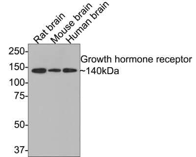 Western Blot: Growth Hormone R Antibody (JU01-34) [NBP2-75518] - Analysis of Growth hormone receptor on different lysates with Rabbit anti-Growth Hormone R antibody at 1/500 dilution. Lane 1: Rat brain tissue lysate Lane 2: Mouse brain tissue lysate Lane 3: Human brain tissue lysate Lysates/proteins at 20 ug/Lane. Predicted band size: 71 kDa Observed band size: 140 kDa Exposure time: 2 minutes; 8% SDS-PAGE gel. Proteins were transferred to a PVDF membrane and blocked with 5% NFDM/TBST for 1 hour at room temperature. The primary antibody at 1/500 dilution was used in 5% NFDM/TBST at room temperature for 2 hours. Goat Anti-Rabbit IgG - HRP Secondary Antibody at 1:300,000 dilution was used for 1 hour at room temperature.