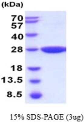 SDS-Page: Gstp2 Recombinant Protein [NBP2-52243] - 15% SDS Page (3 ug)