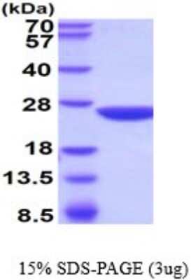 SDS-Page: Gstp2 Recombinant Protein [NBP2-52315] - 15% SDS Page (3 ug)