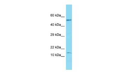 Western Blot: Gtlf3b Antibody [NBP3-09665] - Western blot analysis of Gtlf3b in Fetal Brain lysates. Antibody dilution at 1.0ug/ml