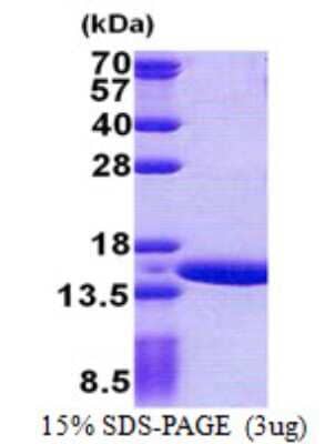 SDS-Page: Gtlf3b Protein [NBP2-22780]