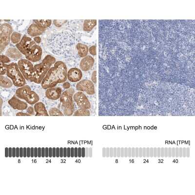 Immunohistochemistry-Paraffin: Guanine deaminase Antibody [NBP1-87454] - Staining in human kidney and lymph node tissues using anti-GDA antibody. Corresponding GDA RNA-seq data are presented for the same tissues.